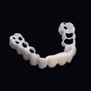 Snap-On Veneers Full Set von Celebrities Secret – maßgefertigte Veneers für Ober- und Unterkiefer